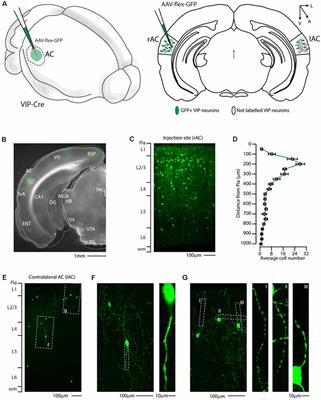 Corticofugal VIP Gabaergic Projection Neurons in the Mouse Auditory and Motor Cortex